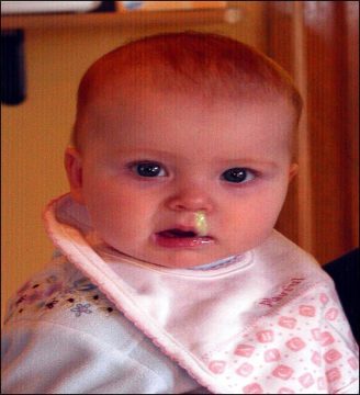 Snoterpillar Attack!