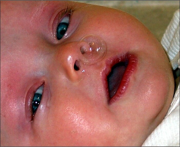 Attack of the Snoterpillars