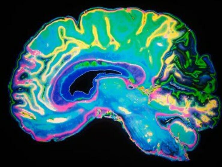 The Neuroscience Behind Stress and Learning