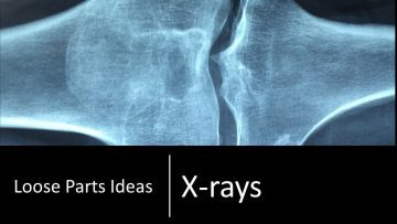 X-Rays