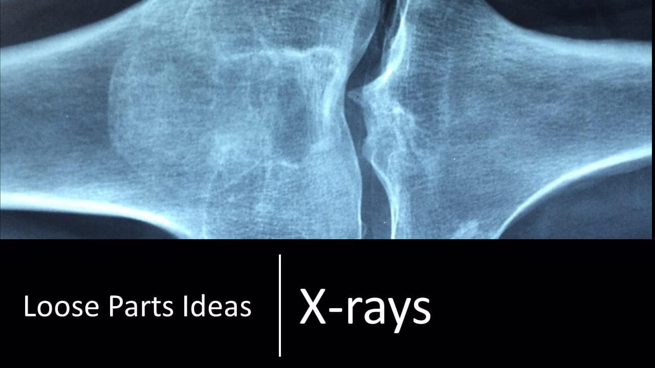 X-Rays