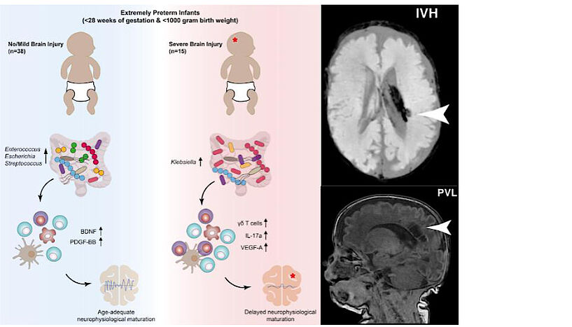 Gut bacteria influence brain development