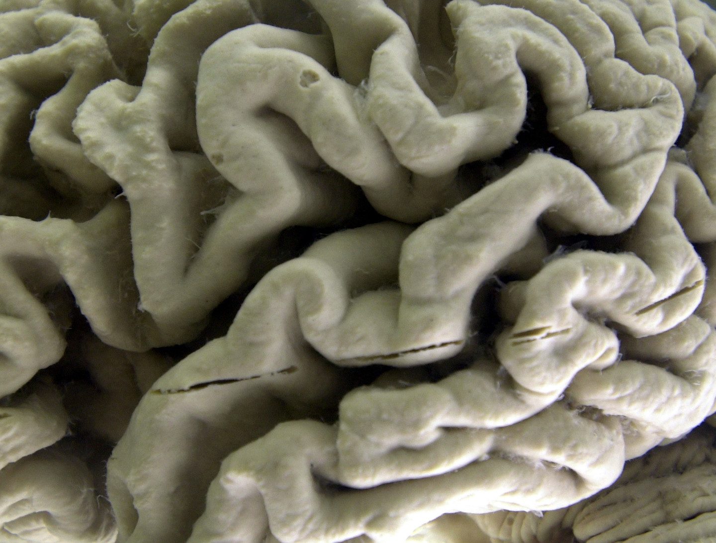Why Brain Wrinkles and Folds Matter