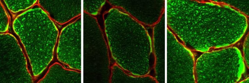 Uncovered: Key to how exercise protects against consequences of aging