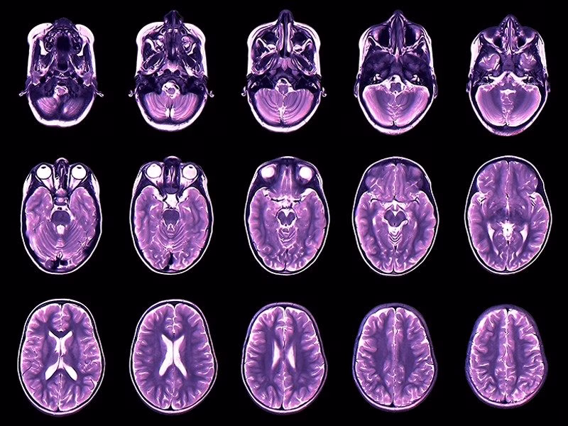Your brain expands and shrinks over time — these charts show how